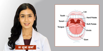 के मुख स्वास्थ्य मुखसँग मात्र सम्बन्धित छ? 